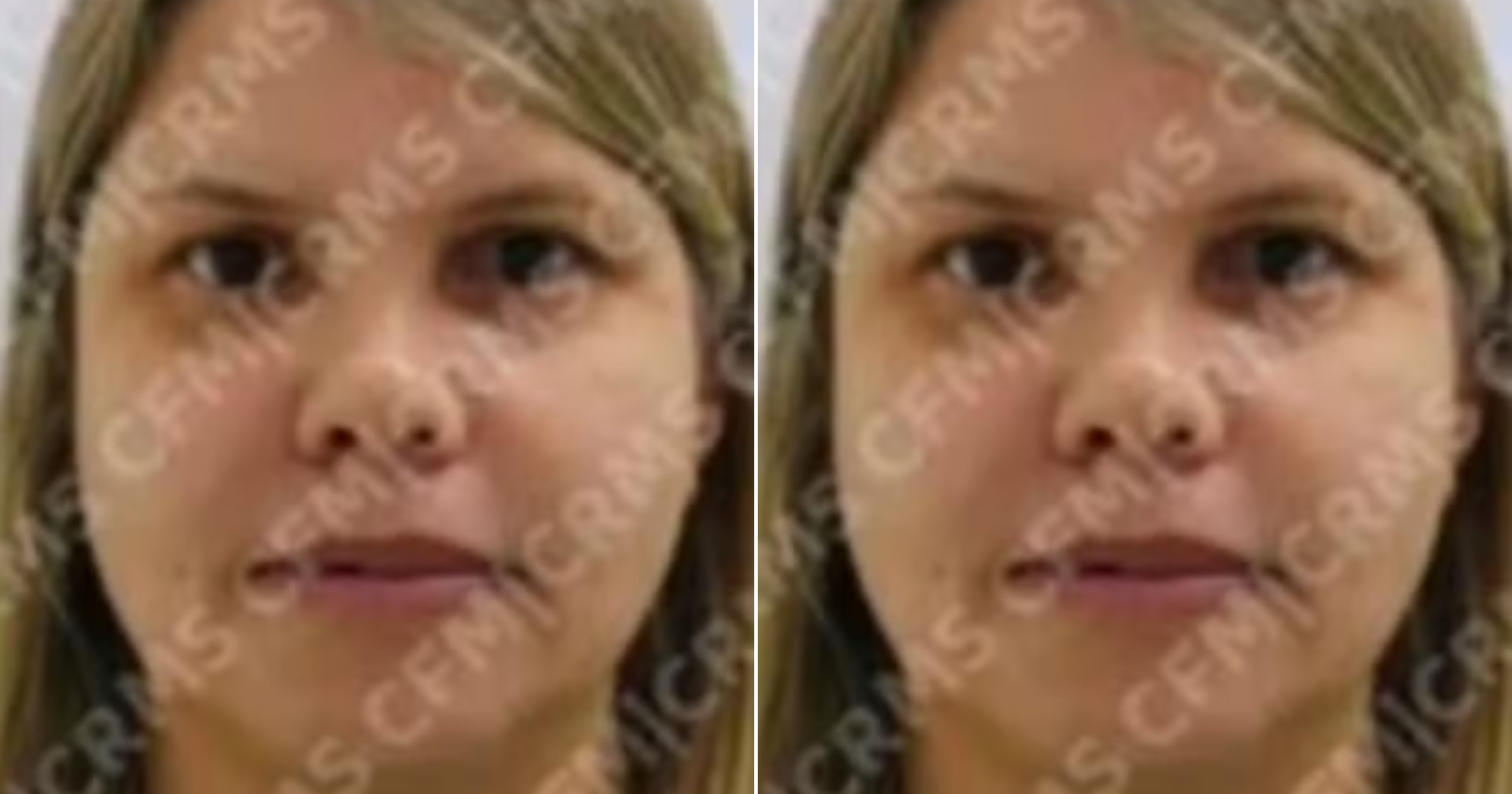 Médica presa suspeita de integrar grupo responsável por falsificar diplomas de medicina é solta dez dias após prisão
